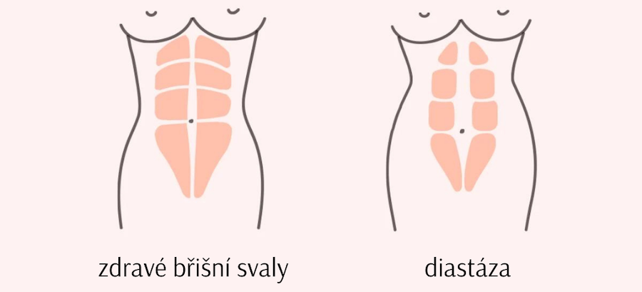 Pošvanc Fitness diasáza
