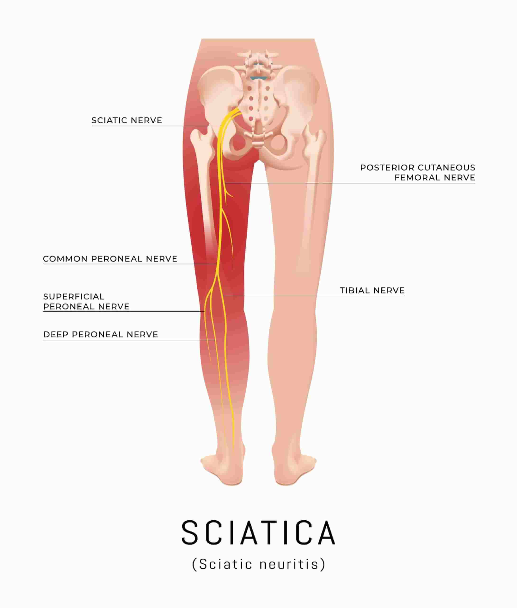 sedací nerv